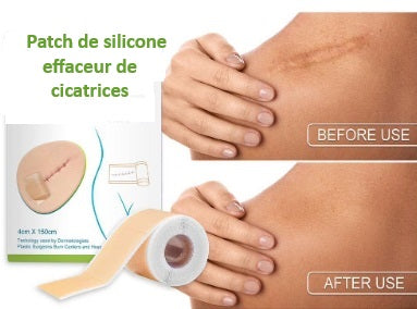 Patch de silicone "Effaceur de Cicatrices."